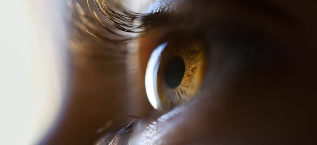 kornea nedir hastalıkları ve tedavileri