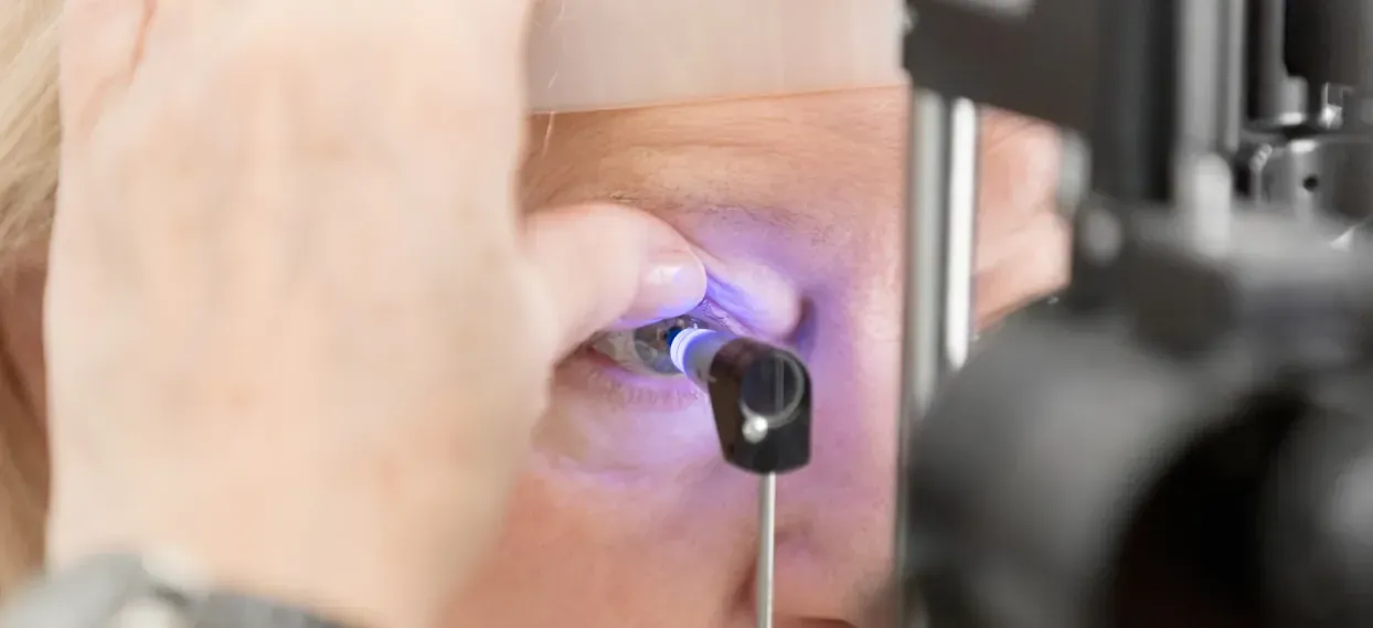 Glaucoma