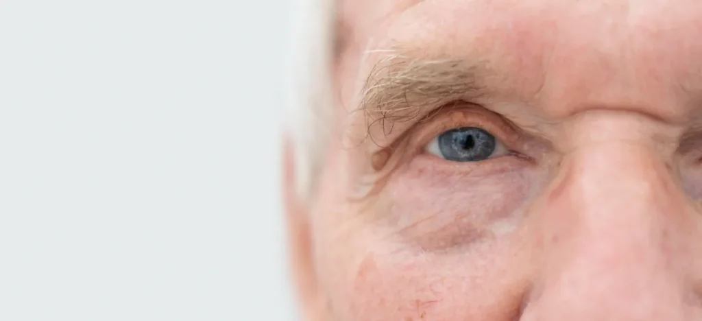 trifocal lens surgery
