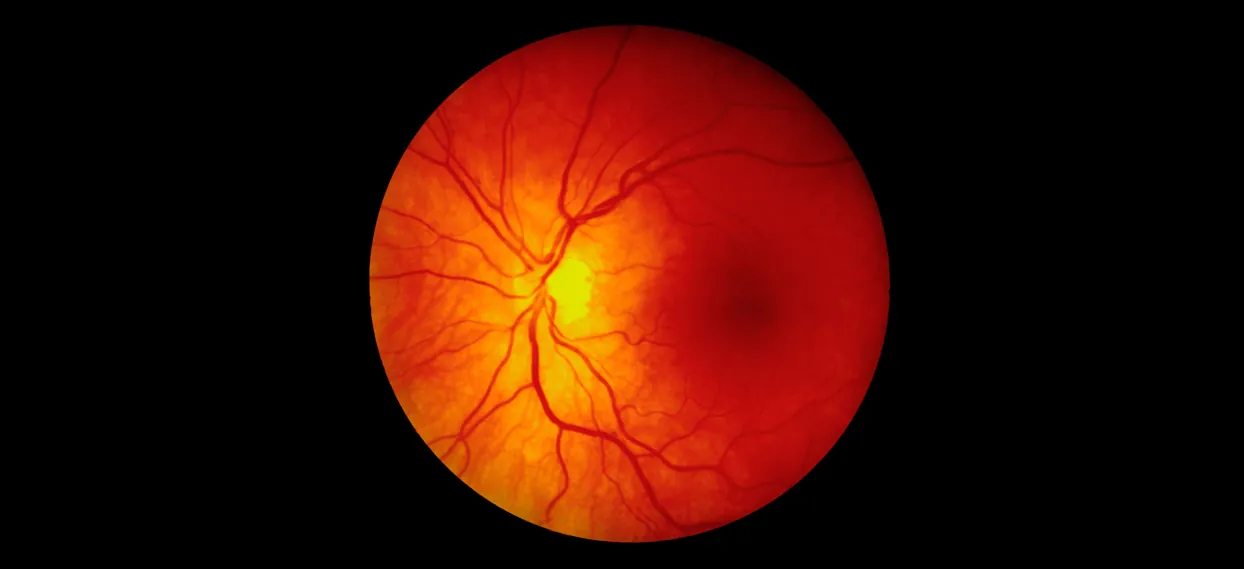 Retina Cerrahisi